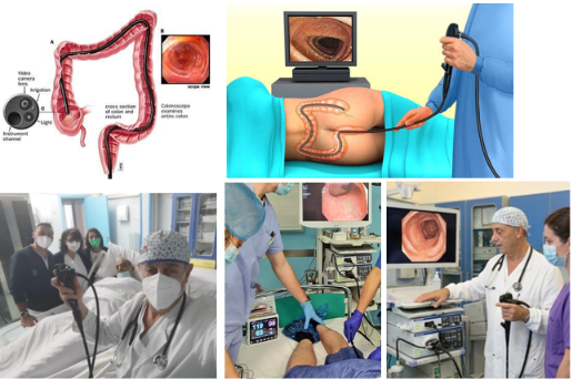 Colonscopia ed esame endoscopico del colon